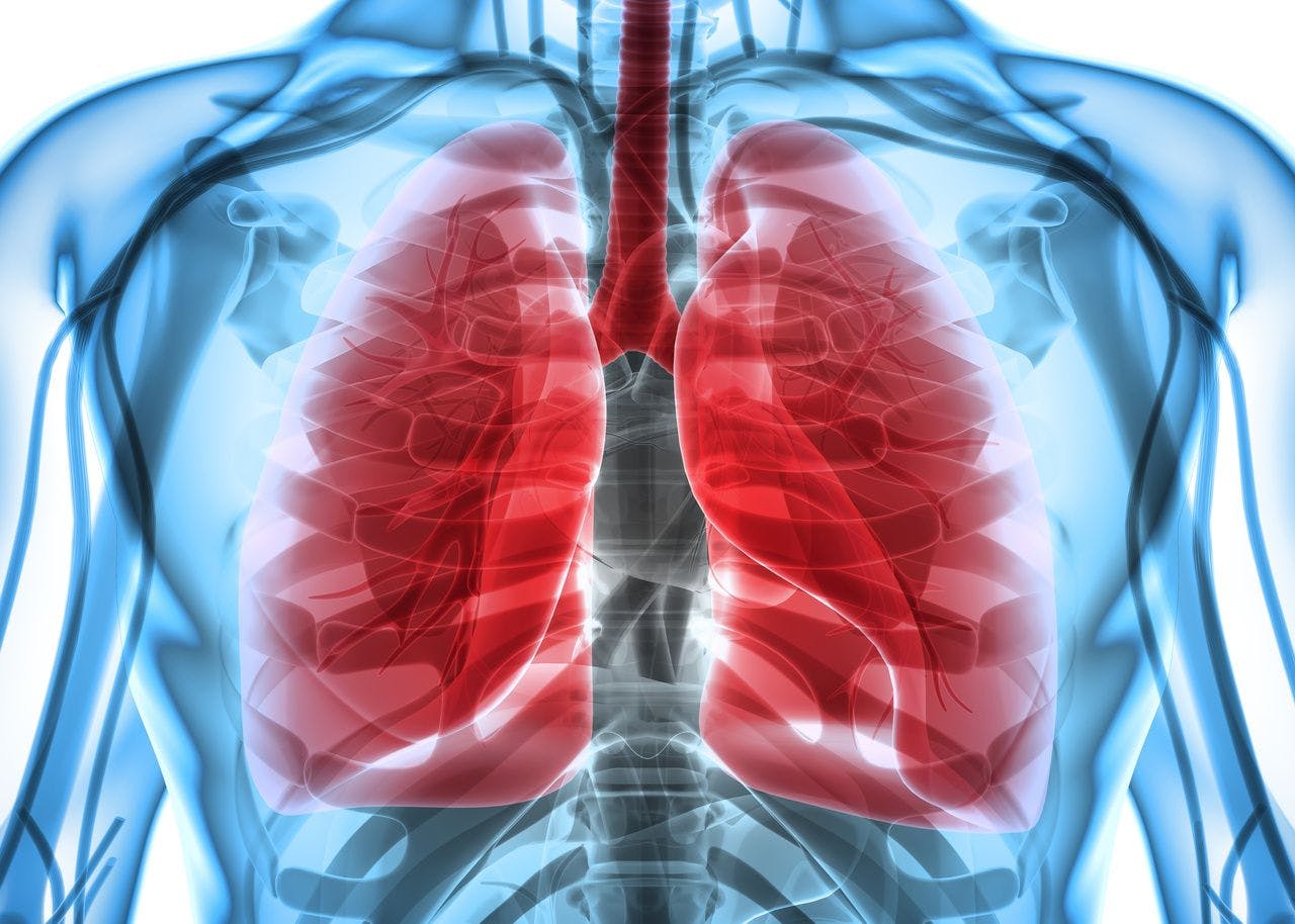 PAH-affected lungs