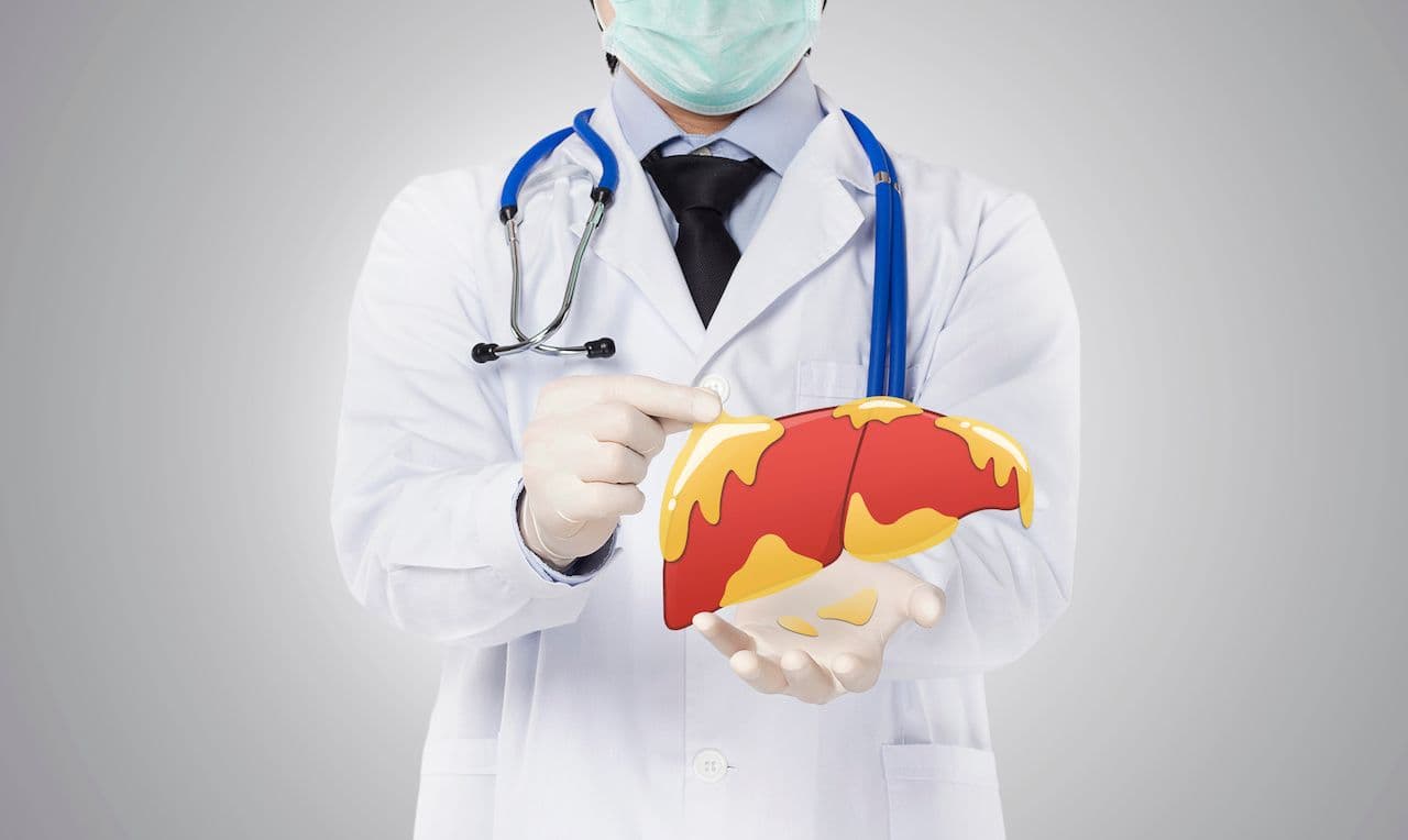 Doctor holding a fatty liver | Image credit: TANABOON - adobe.stock.com