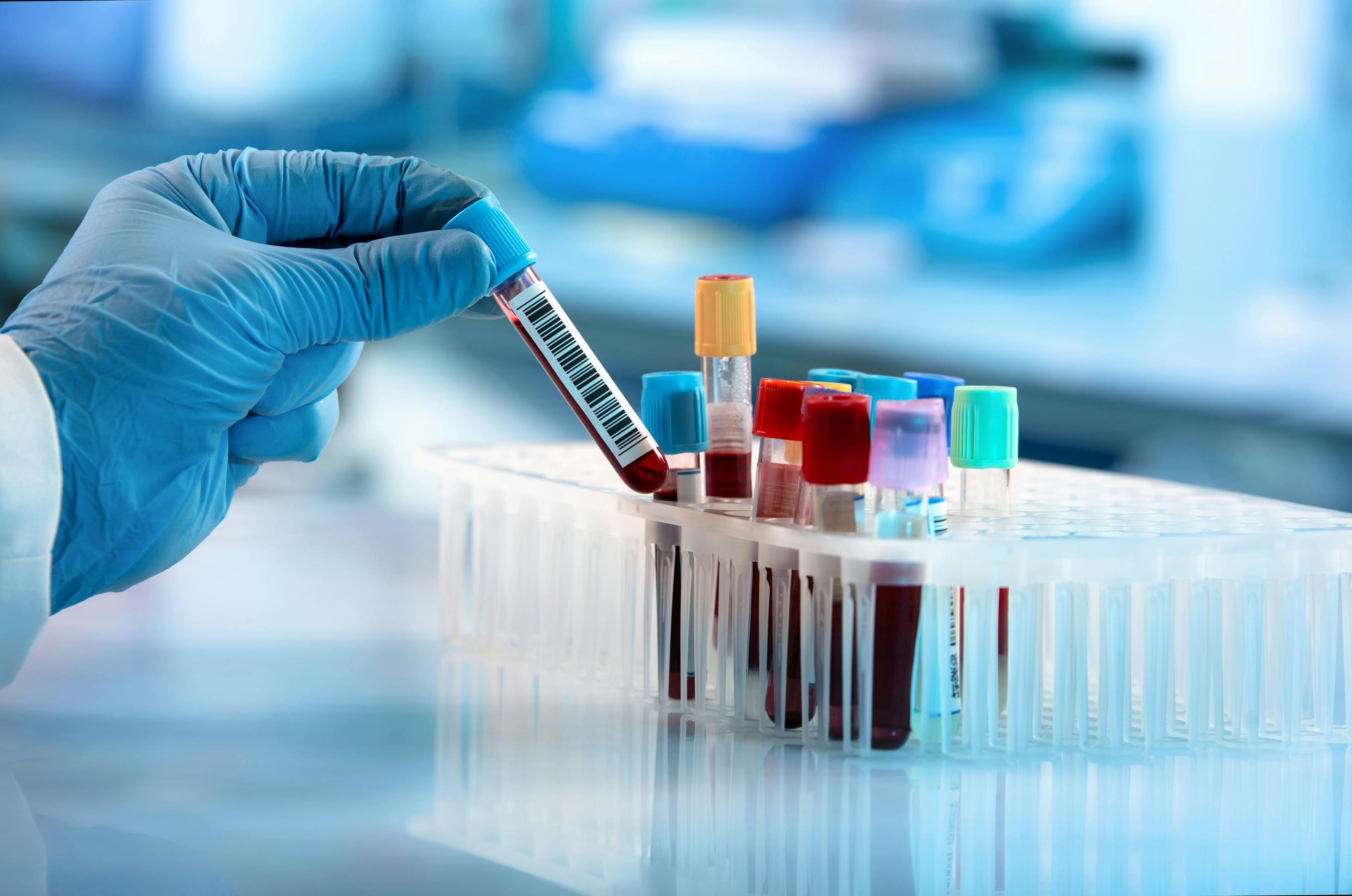 The Shield blood test provides an alternate method for screening for colorectal cancer | Image credit: angellodeco - stock.adobe.com