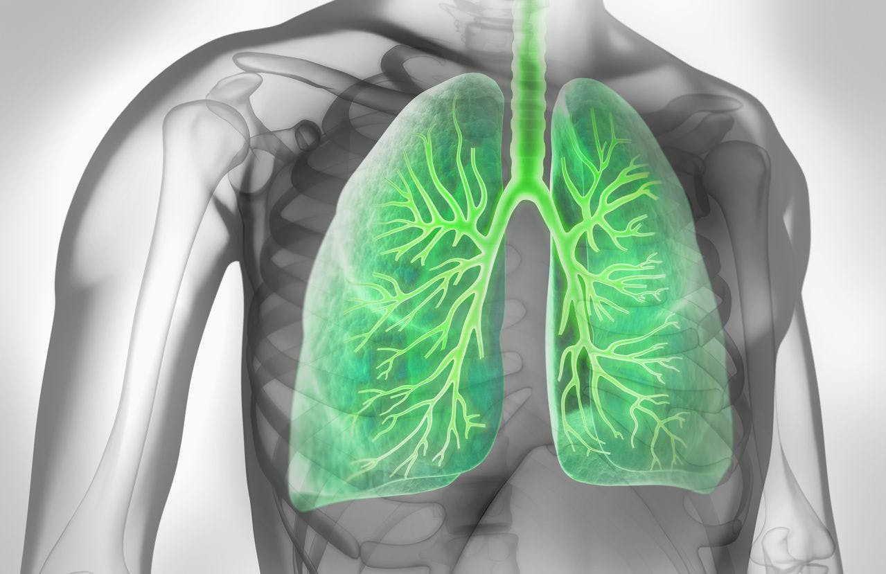 Coexisting COPD Increases Mortality in Patients With More Severe Asthma