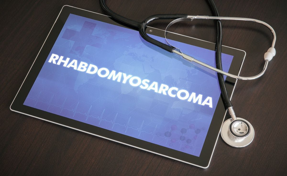 rhabdomyosarcoma | Image Credit: ibreakstock-stock.adobe.com