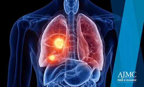 Explore recent advances in small cell lung cancer management, including staging, treatment options across disease stages, emerging therapies, biomarker testing, and strategies to overcome challenges in diagnosis and care delivery with this Peer Exchange.