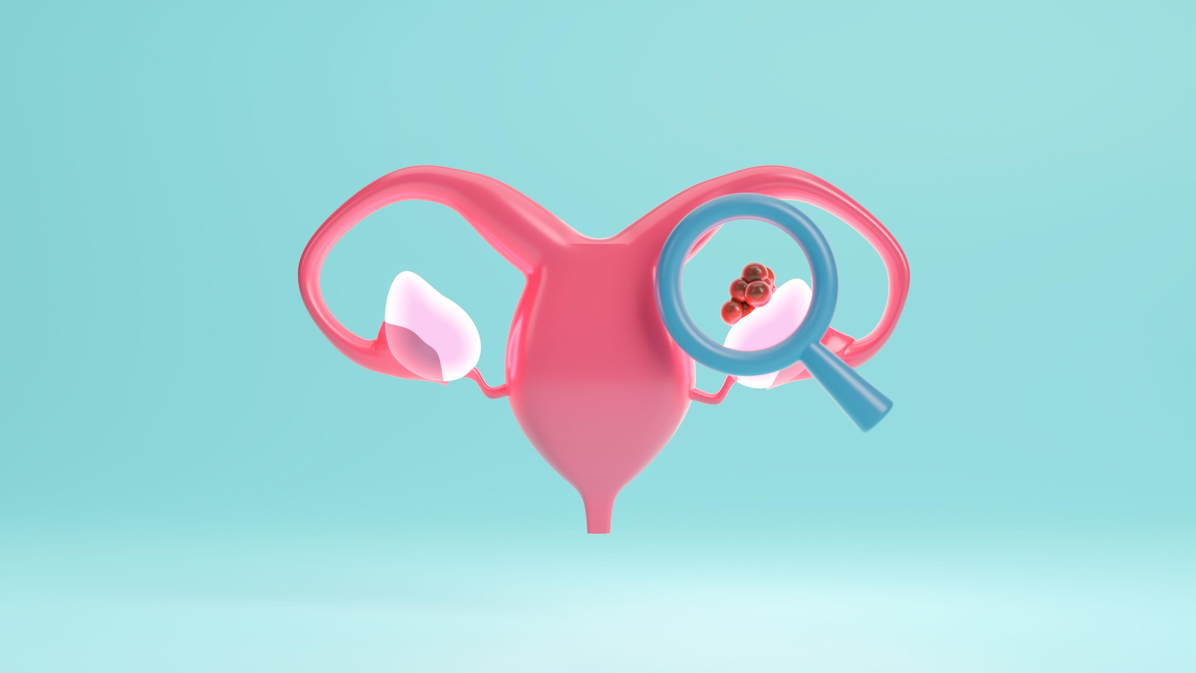 Ovarian cancer animation | Image Credit: Nuchjaree - stock.adobe.com