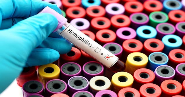 hemophilia | Image Credit: jarun011-stock.adobe.com