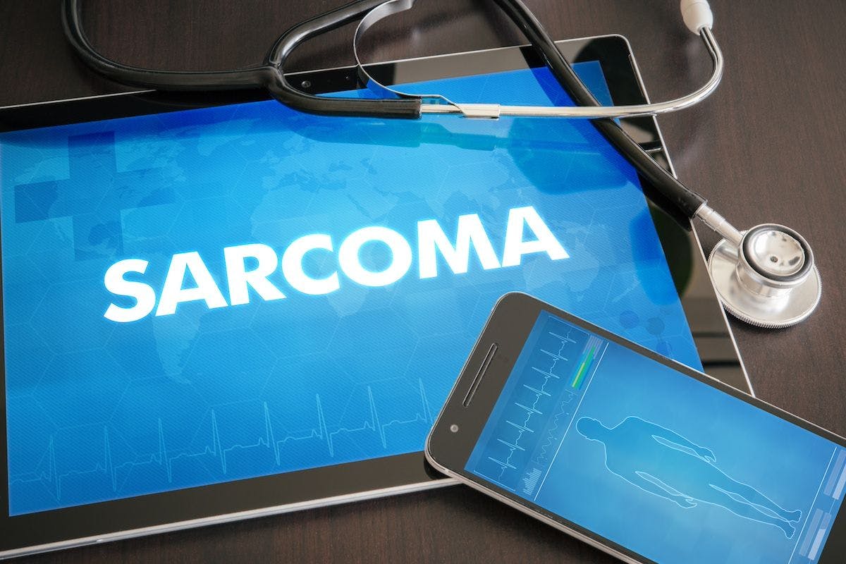 Sarcoma graphic | Image Credit: ibreakstock - stock.adobe.com