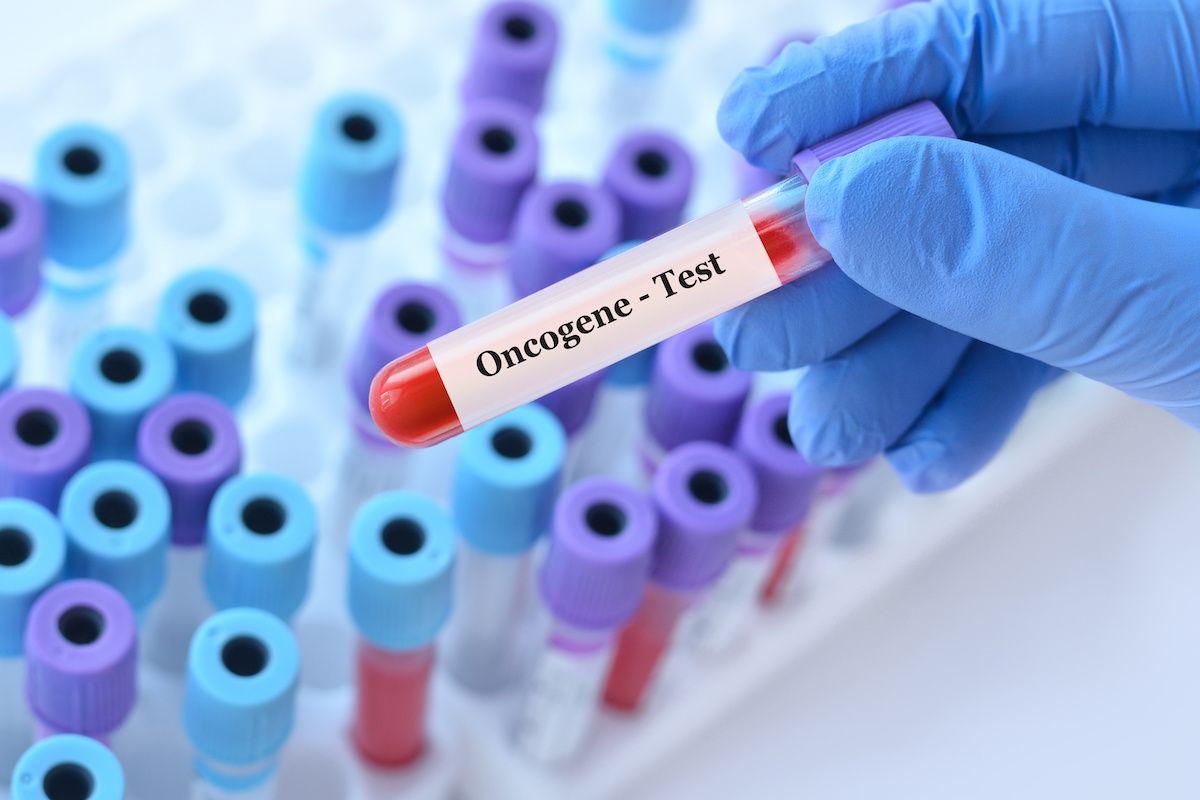 Oncogene test sample | Image Credit: © syhin_stas - stock.adobe.com