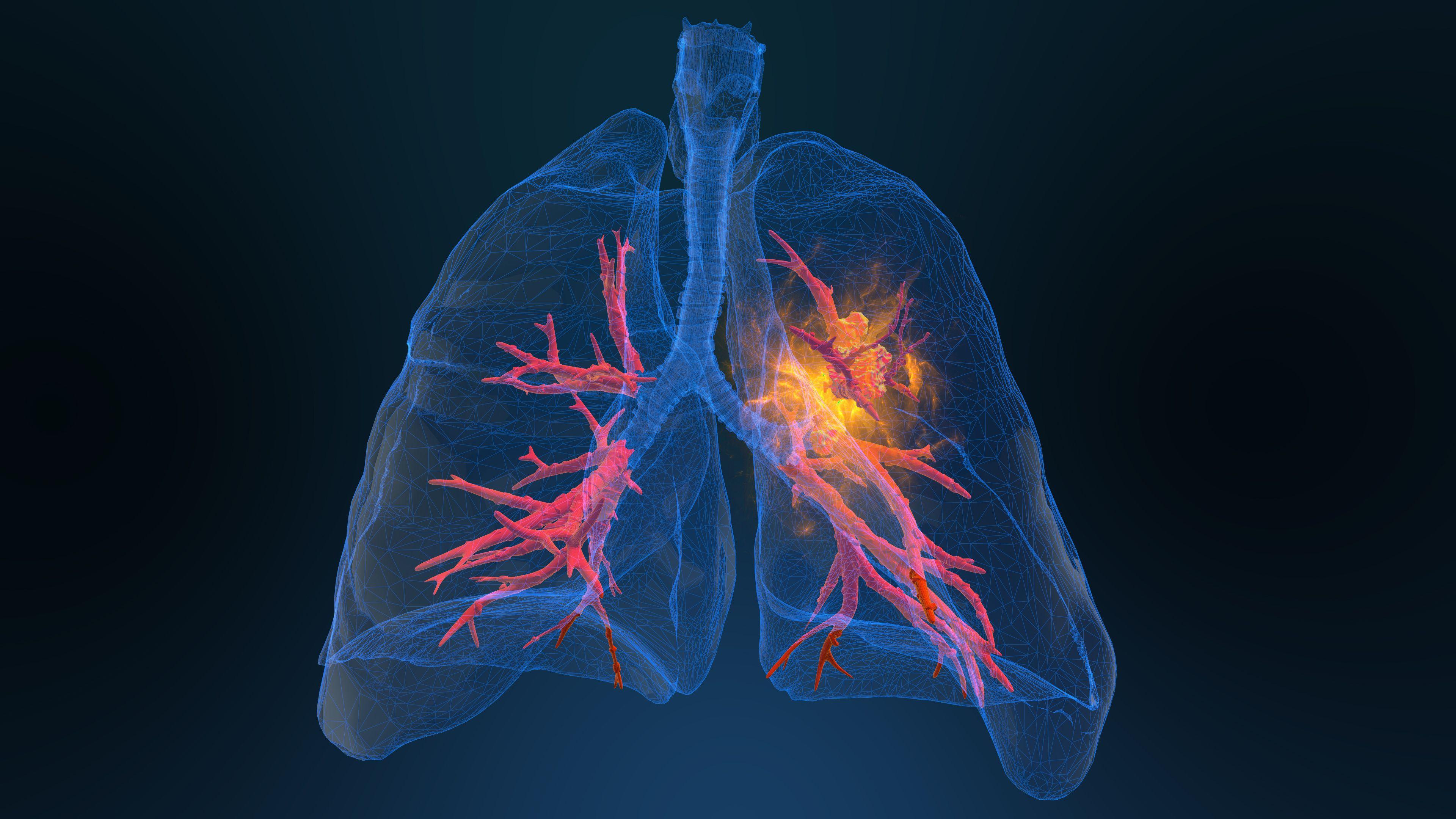 Subsequent line of therapies were not found to be tolerated in patients with NSCLC | Image credit: appledesign - stock.adobe.com