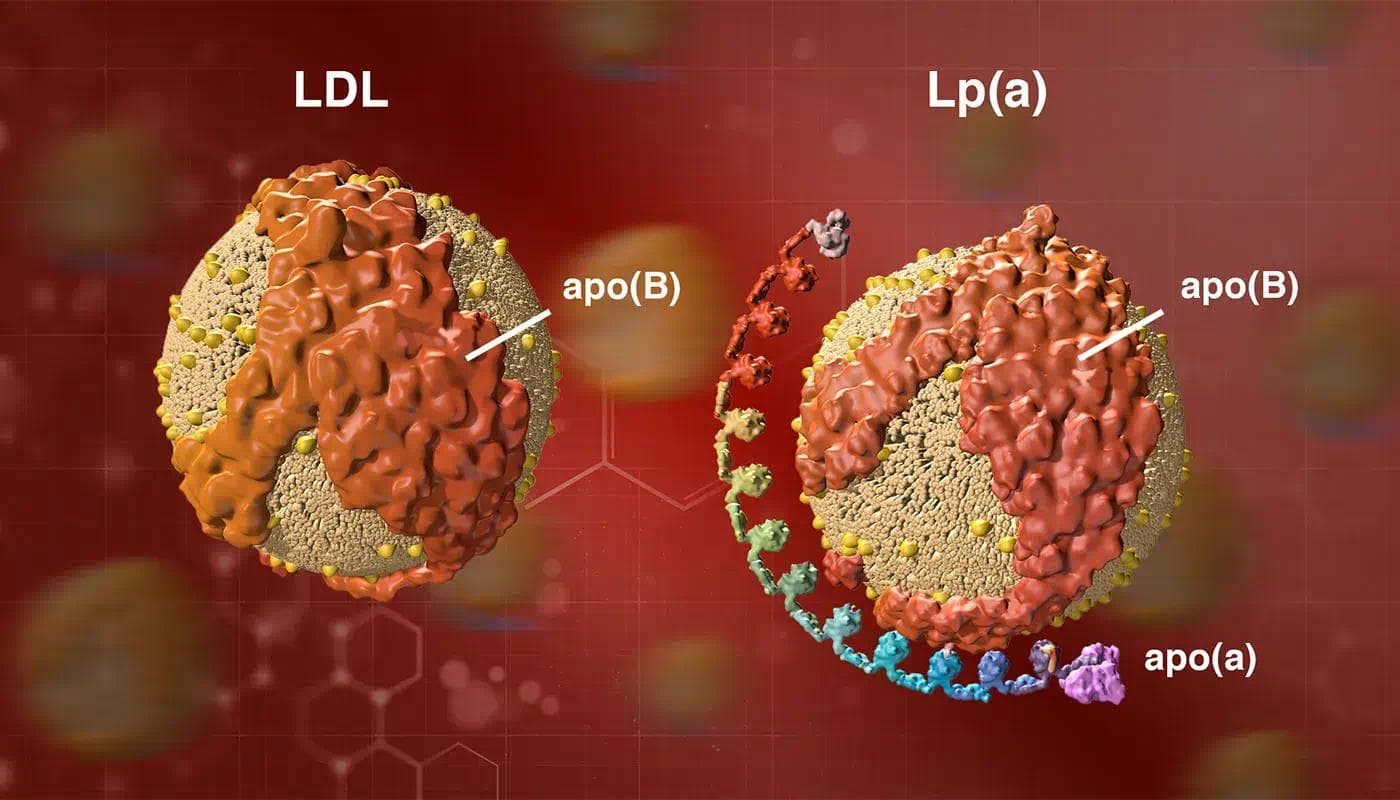 LDL and Lp(a) | Image credit : Amgen