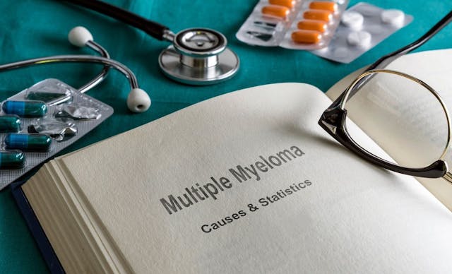 Multiple myeloma | Image Credit: Felipe Caparrós-stock.adobe.com