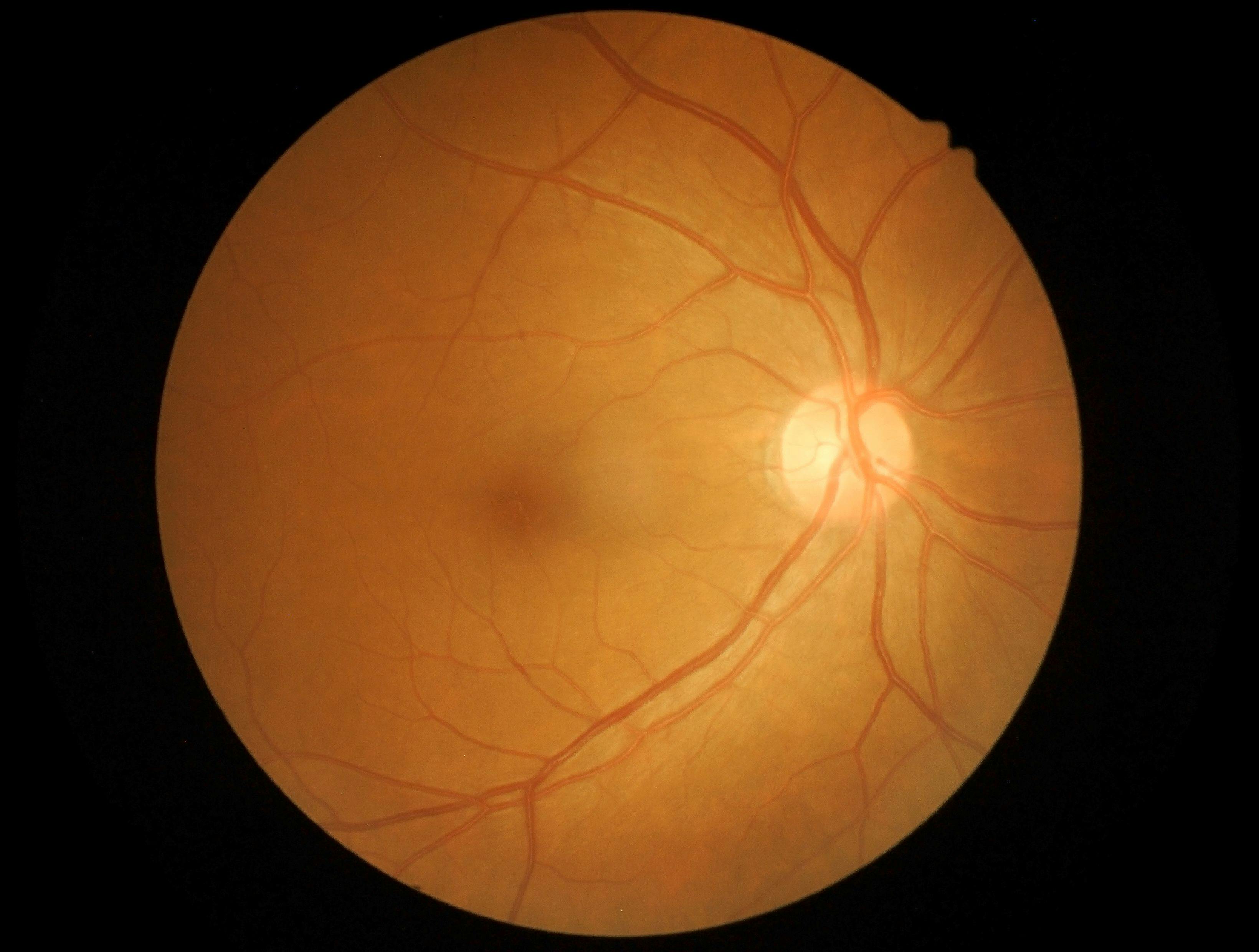 Retina and optic nerve | Image credit: memorisz - stock.adobe.com