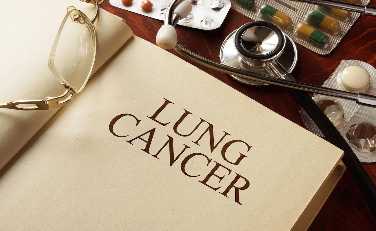 Lung cancer diagnosis | Image Credit: Vitalii Vodolazskyi - stock.adobe.com