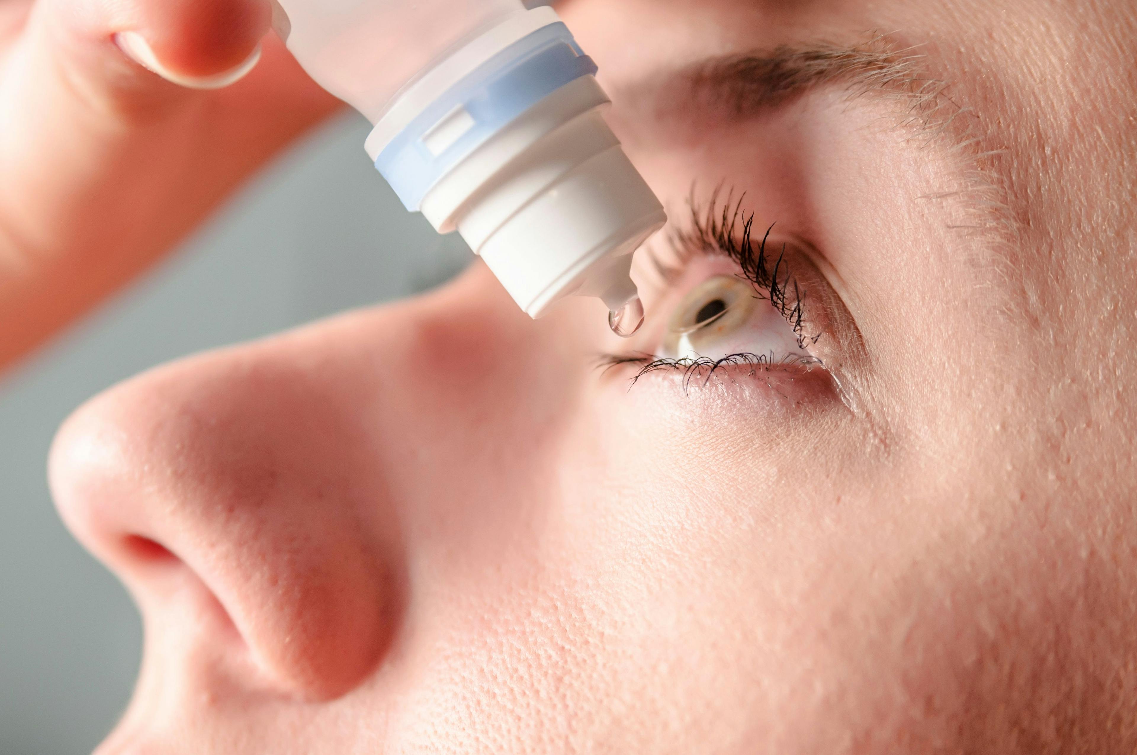 Woman applying eye drops to dry eyes | Image credit: Dragana Gordic - stock.adobe.com