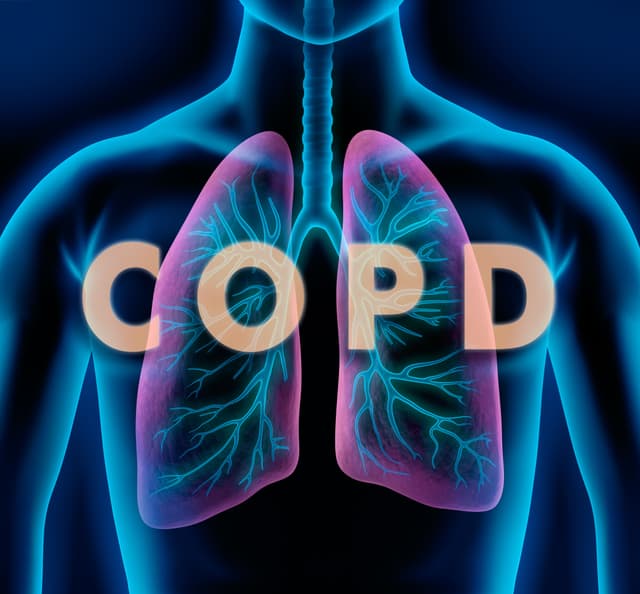 COPD illustration | Image Credit: peterschreiber.media - stock.adobe.com