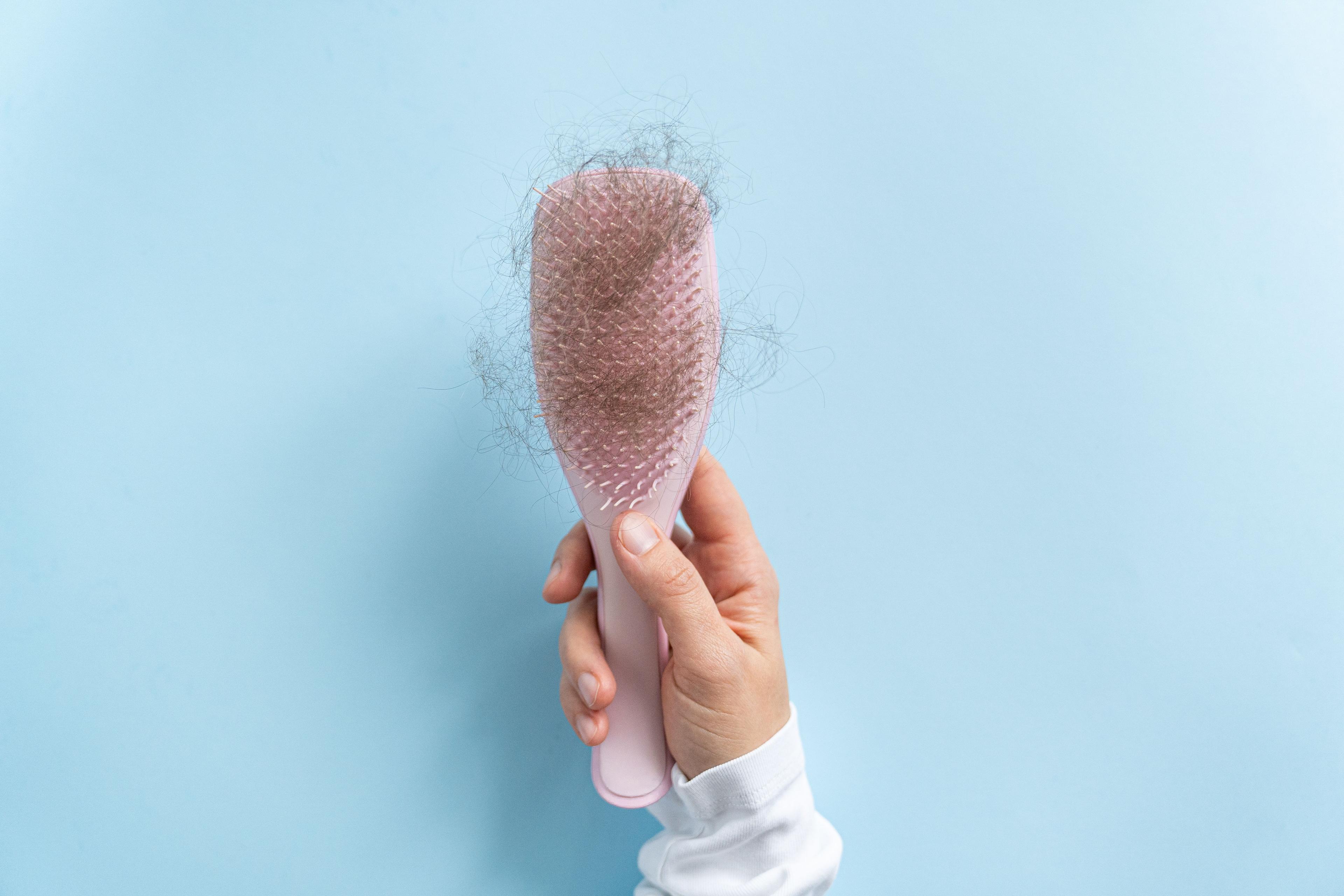 Woman holding brush full of hair | Image Credit: anaumenko - stock.adobe.com