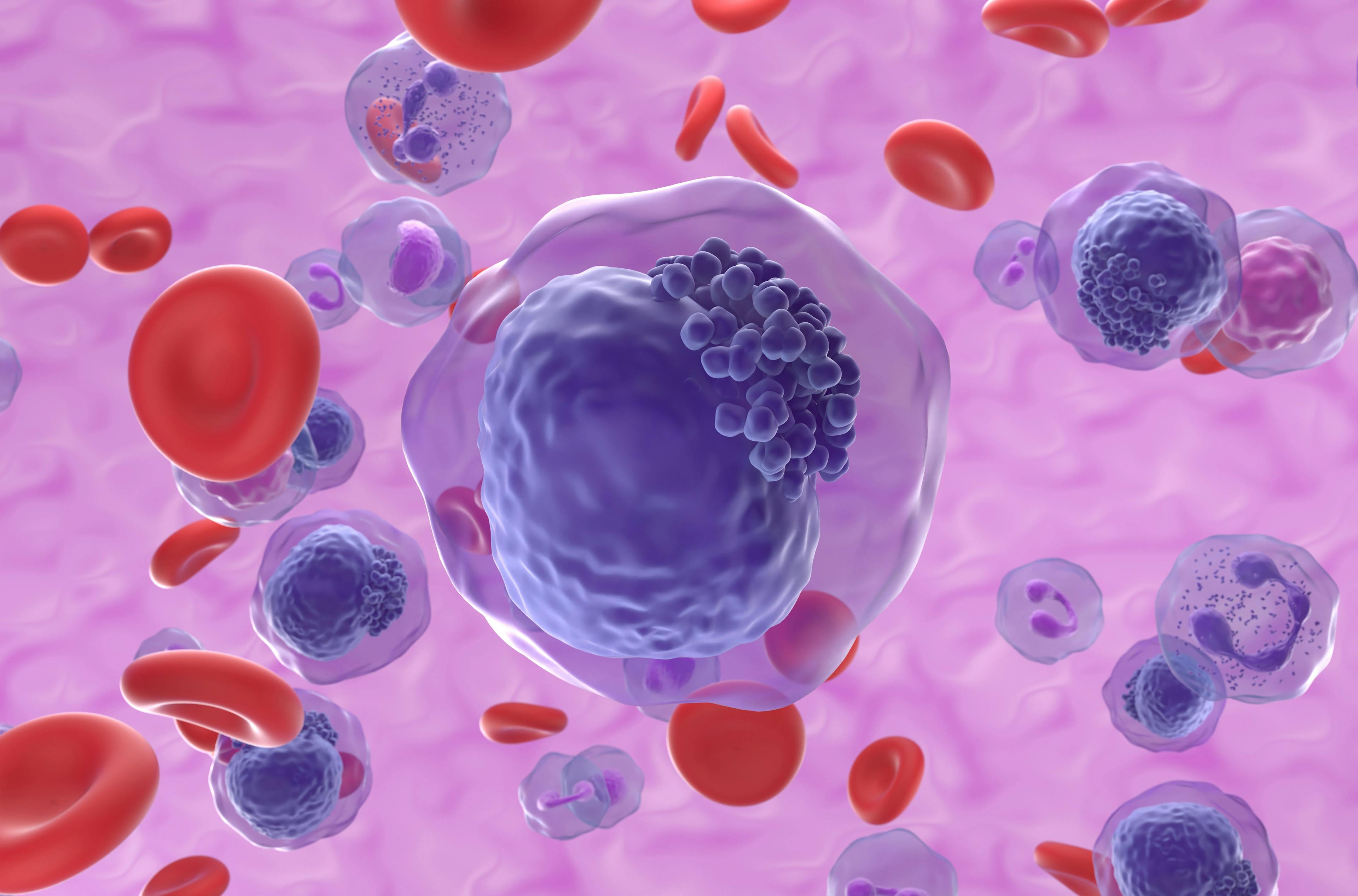 AML cells | image credit: LASZLO - stock.adobe.com