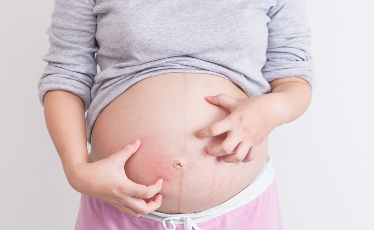 Itchy pregnant belly | Image Credit: © chajamp-stock.adobe.com