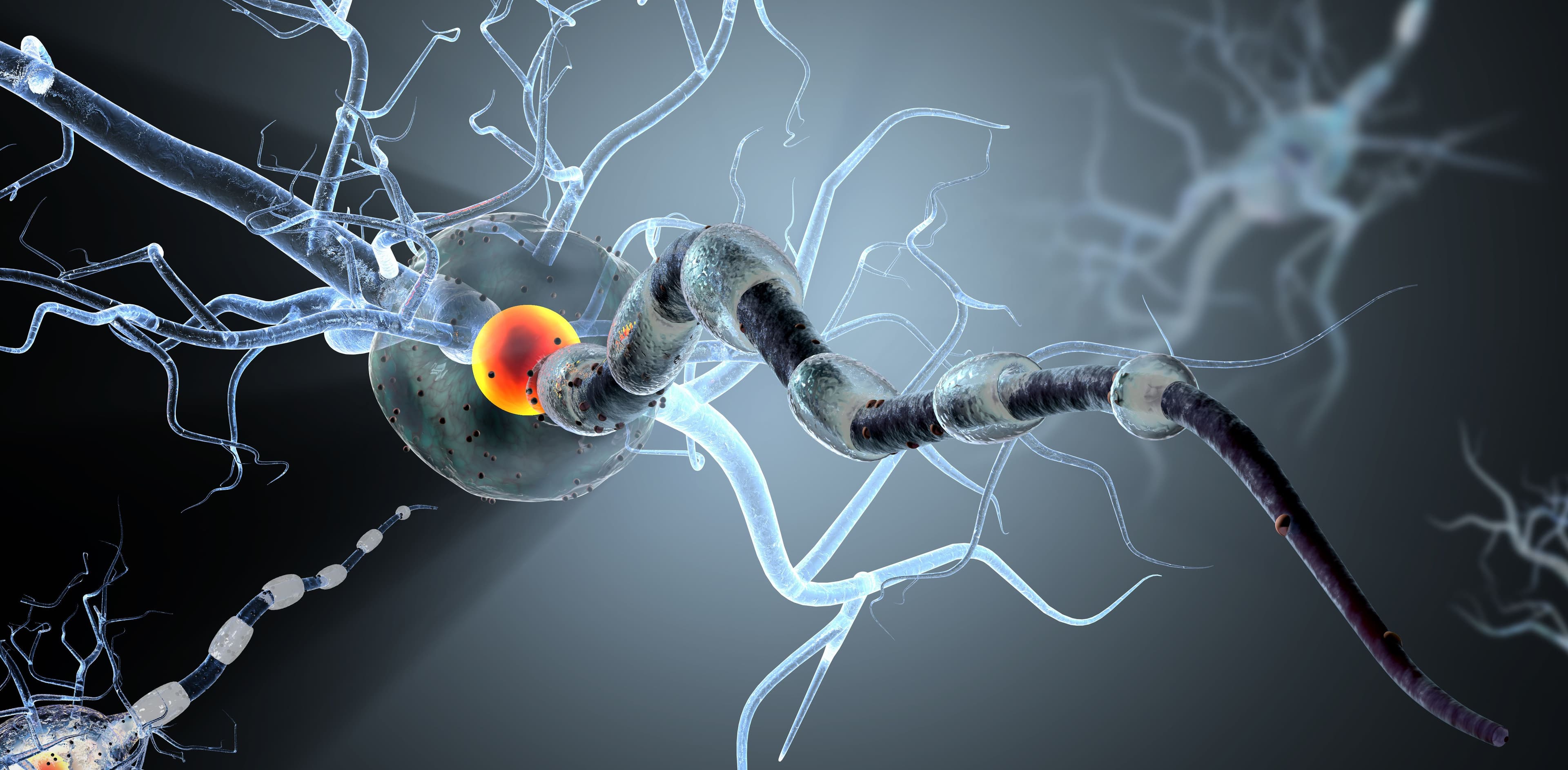 Neurologic disease concept | image credit: ralwel - stock.adobe.com