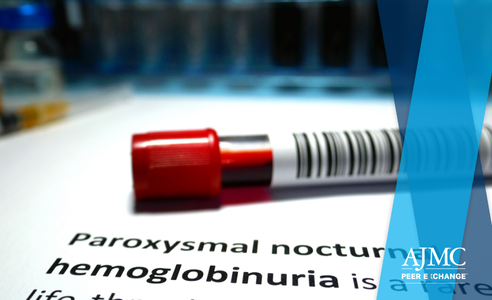 View the latest AJMC Peer Exchange on paroxysmal nocturnal hemoglobinuria (PNH)