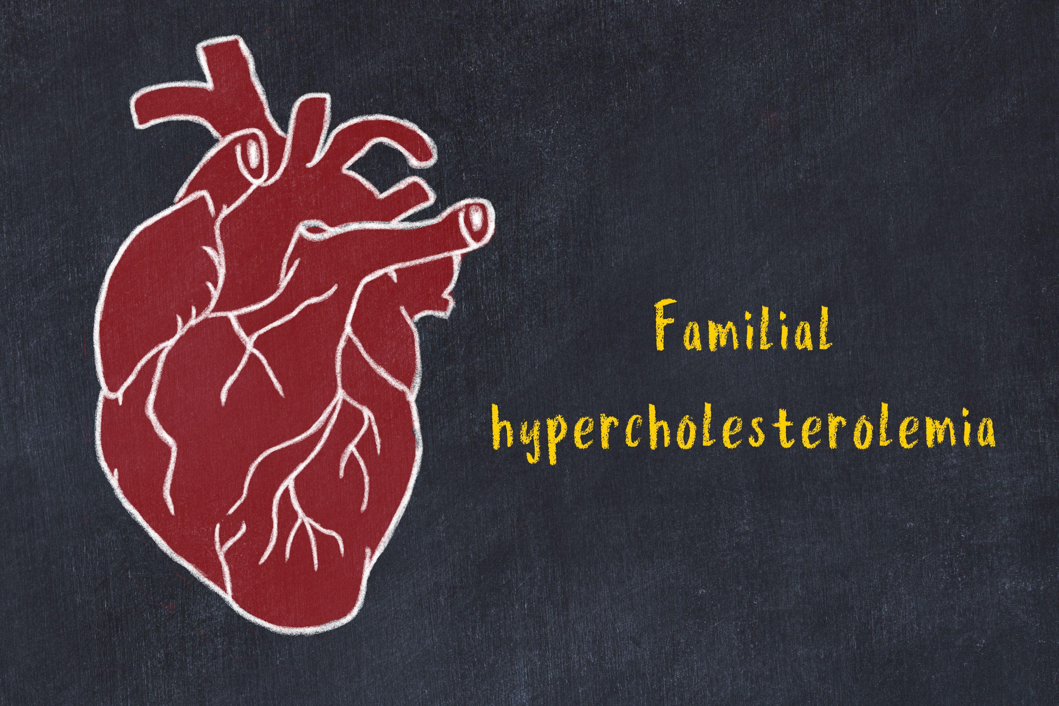 Homozygous familial hypercholesterolemia affects an estimated 1 in 300,000 individuals | image credit: iushakovsky - stock.adobe.com