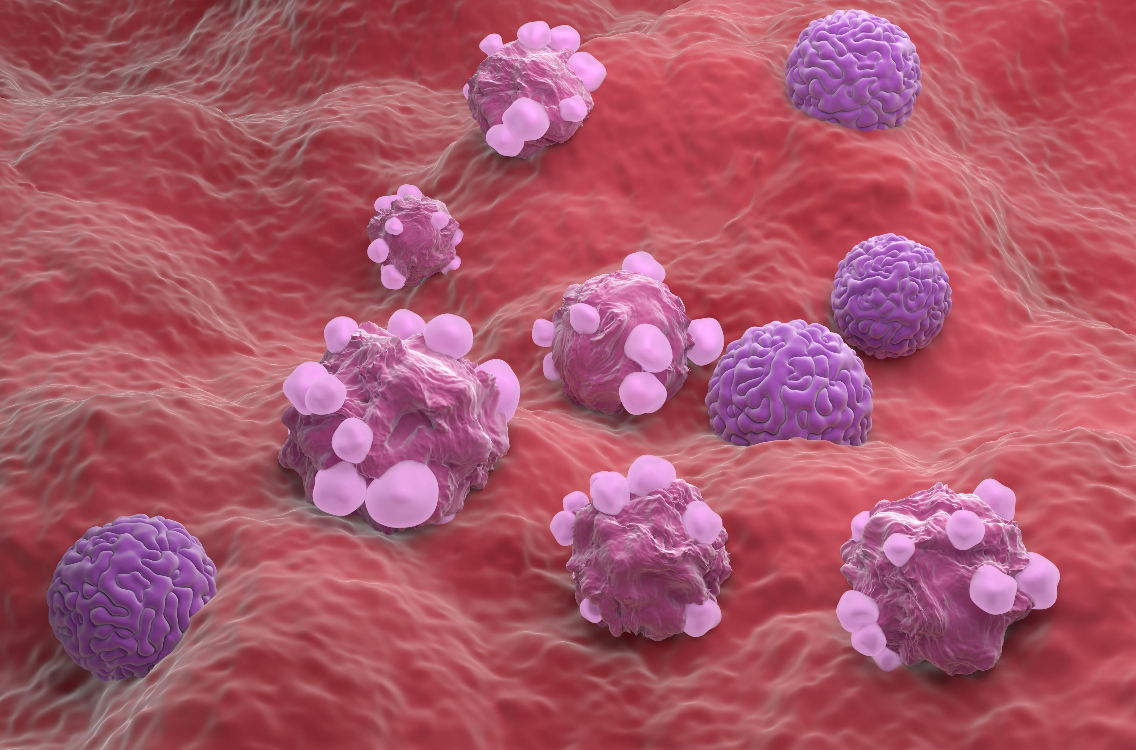 3D illustration of ovarian cancer cells | Image Credit: LASZLO - stock.adobe.com