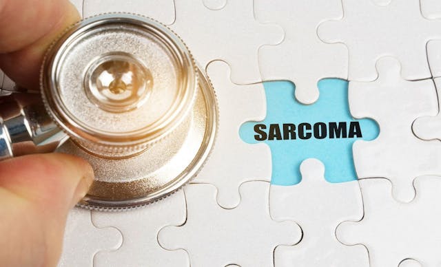 sarcoma | Image Credit: Dzmitry-stock.adobe.com