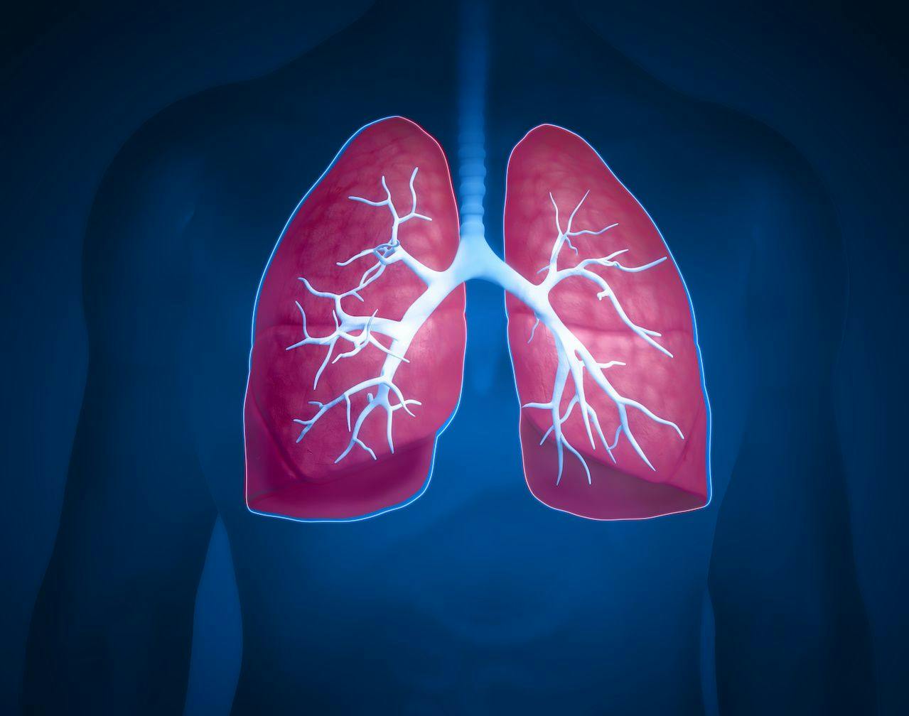 COPD Is a More Likely Comorbid Condition in HIV-Positive Individuals