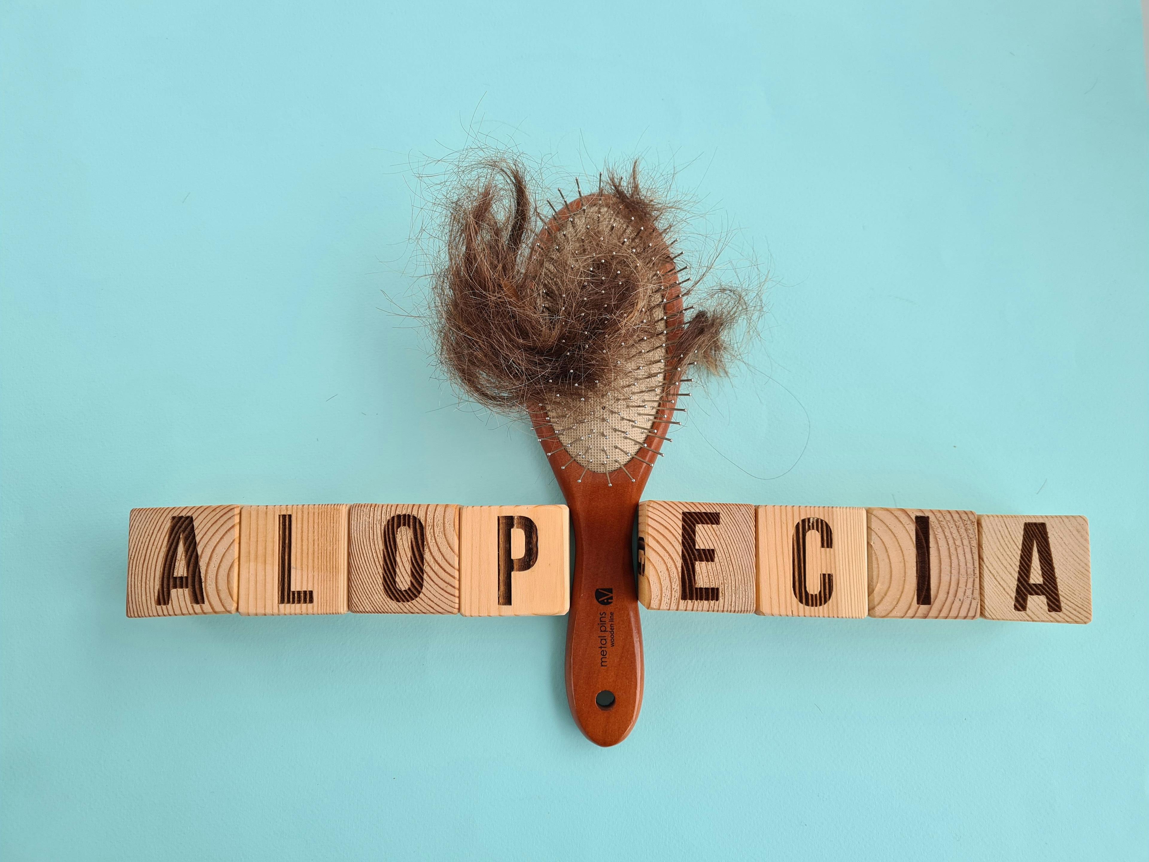 Hair loss on brush with AA text. | Image Credit: Nadzeya- stock.adobe.com