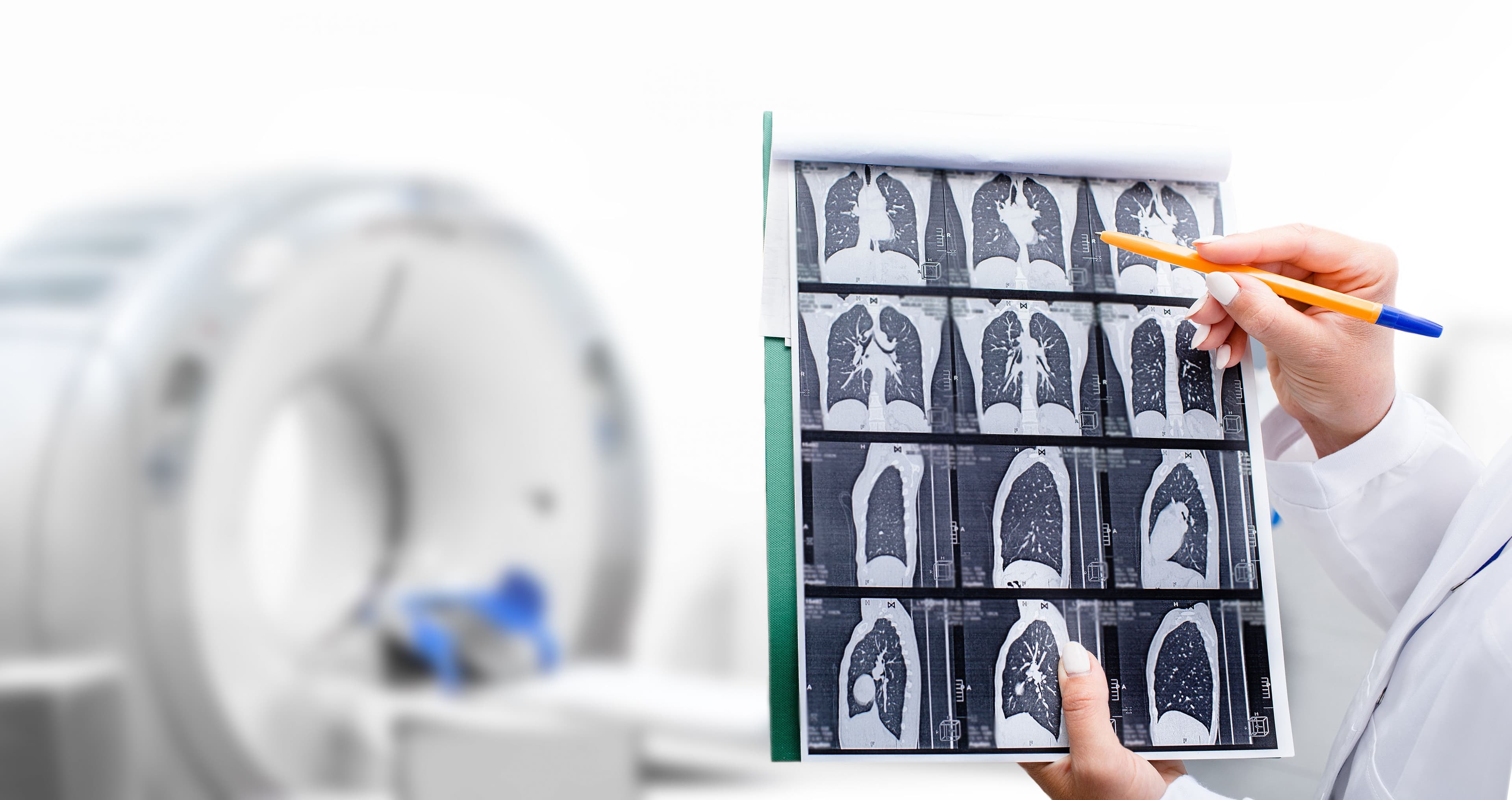 Lung CT scan | Image Credit: Peakstock - stock.adobe.com