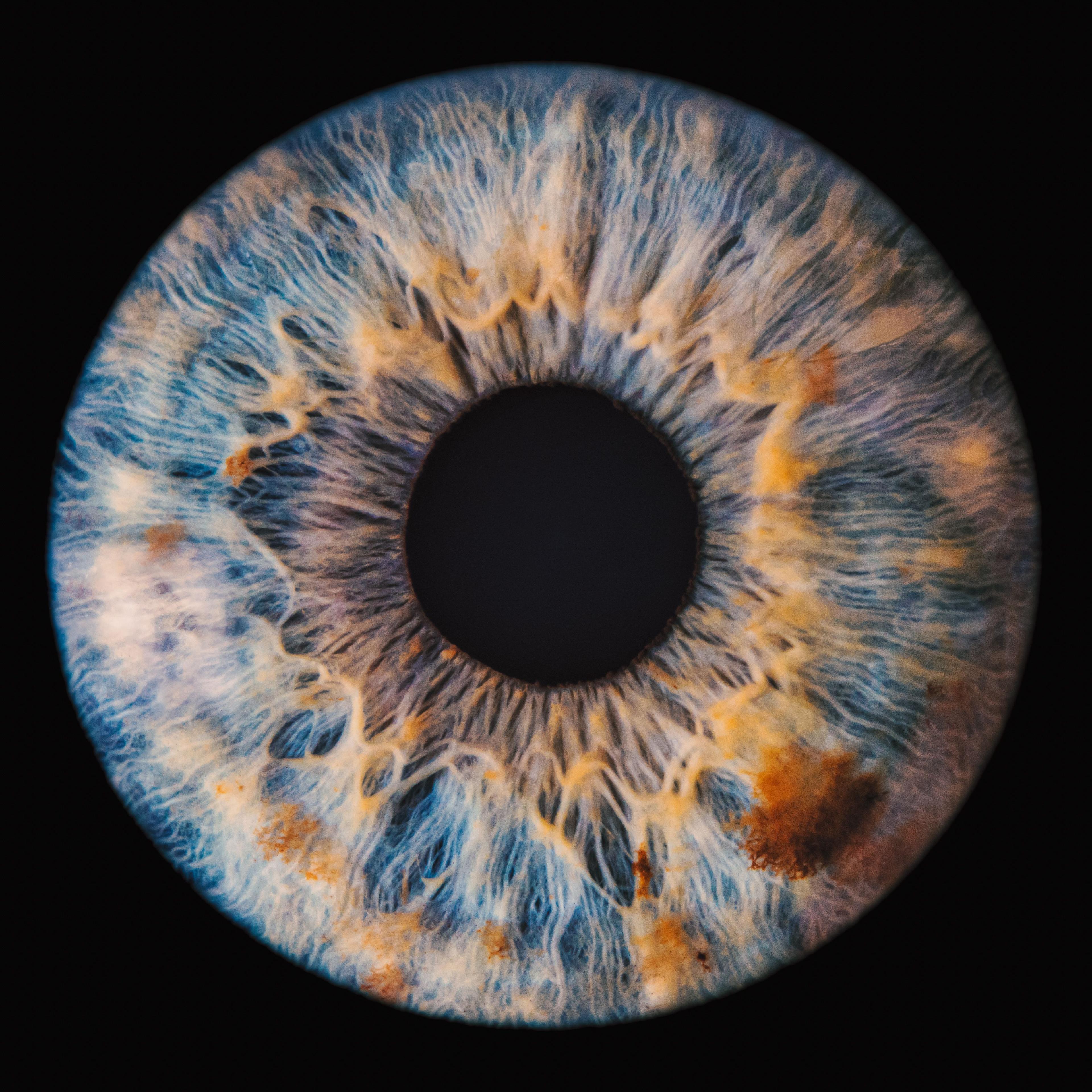 Sickle cell retinopathy is a manifestation of SCD that occurs in the eye and can cause detriments to patients’ vision| Image credit: Lorant - stock.adobe.com