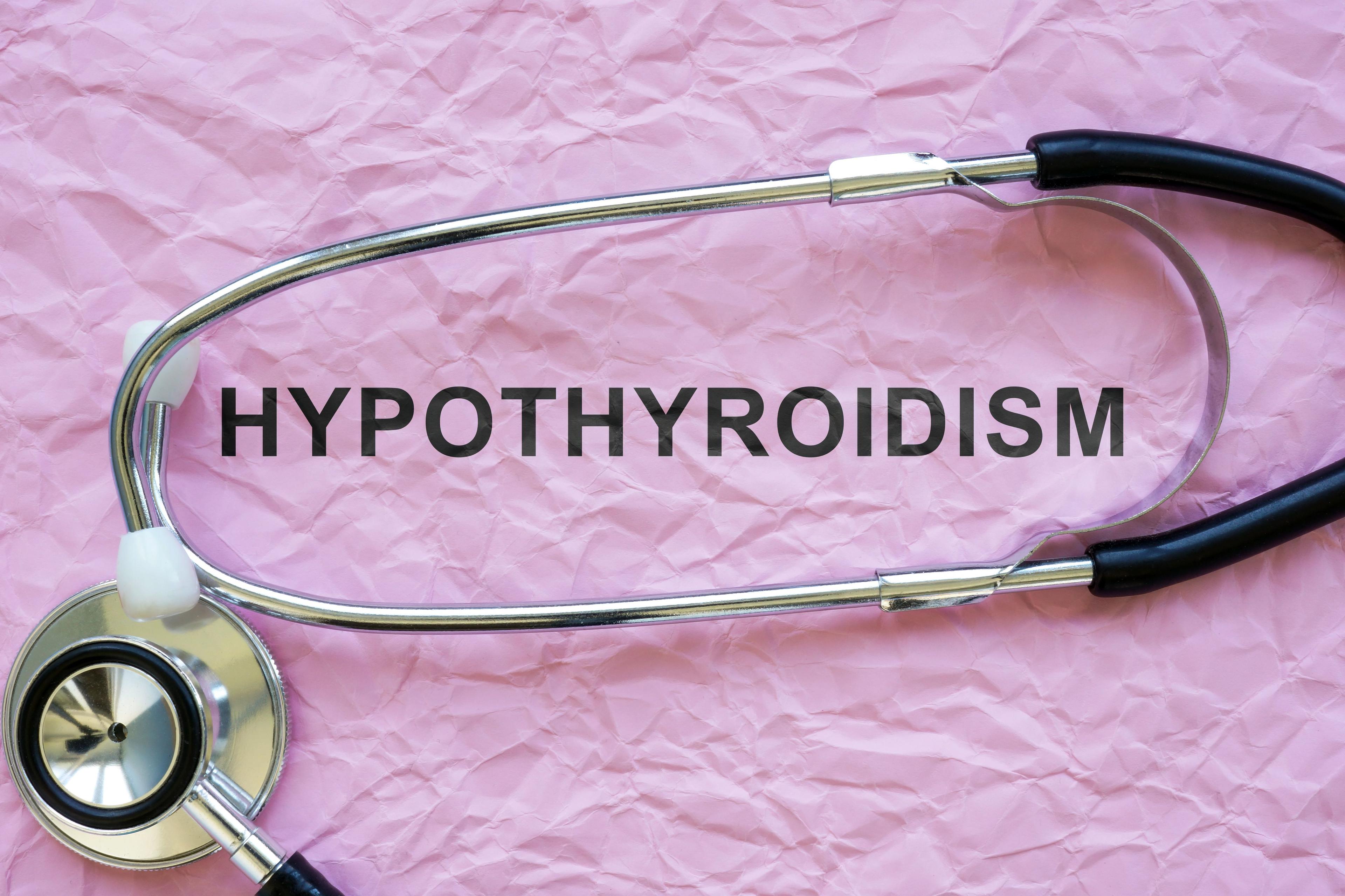 An analysis suggests a potential relationship between hypothyroidism and an increased risk for developing alopecia areata | image credit: Vitalii Vodolazskyi - stock.adobe.com