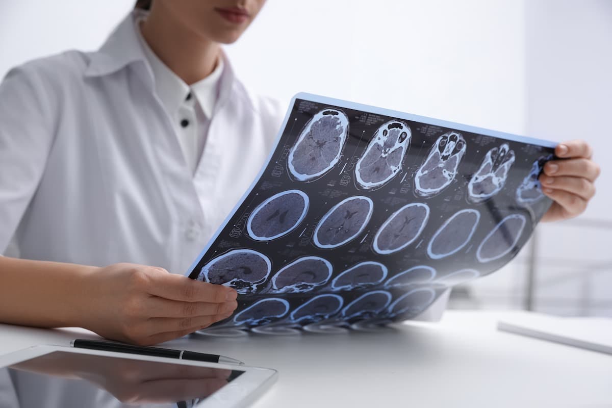 Doctor examining MRI images | Image credit: New Africa - stock.adobe.com