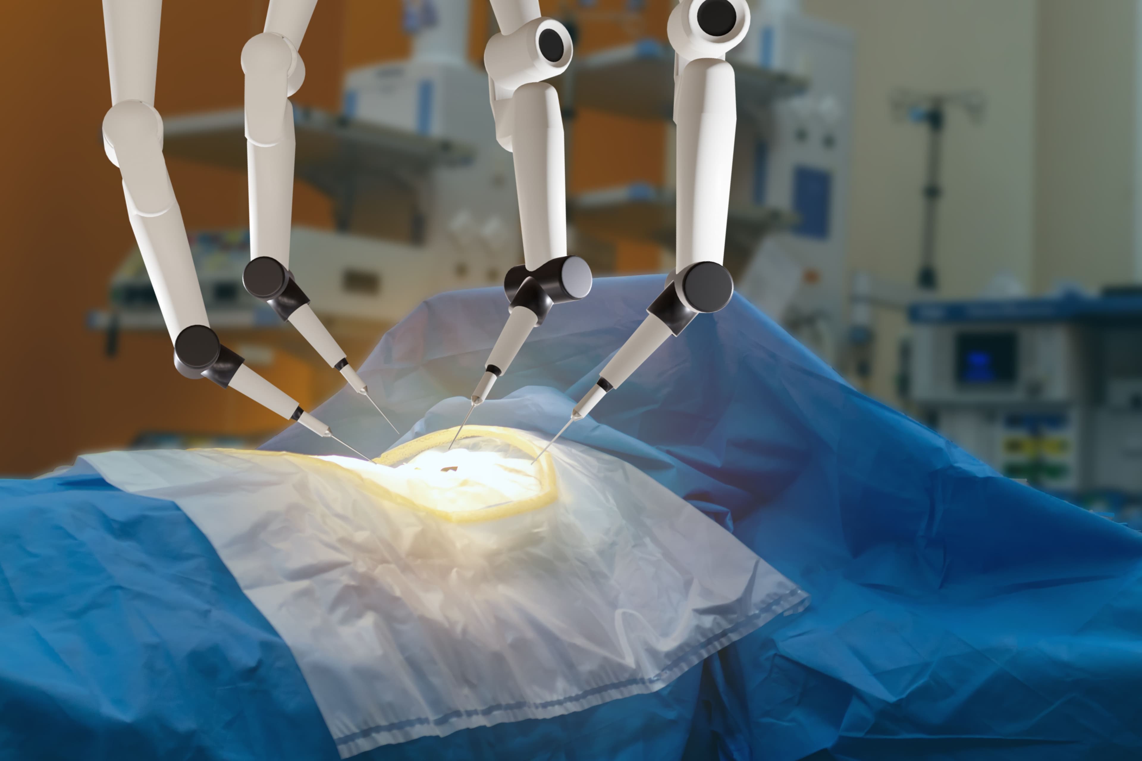 Robotic-assisted surgery is feasible and safe for patients who need colorectal surgery, including resections | Image credit: Monopoly919 - stock.adobe.com