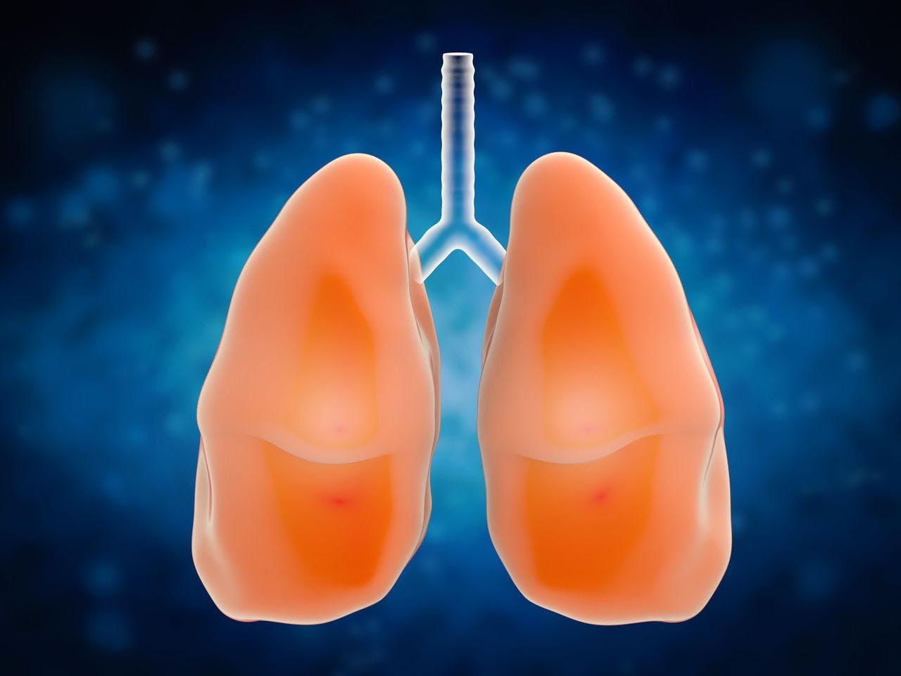 FDA OKs First Treatment for Rare Lung Disease