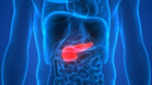 Study Links Presence of Oral Bacteria in Pancreas to Severity of Tumors