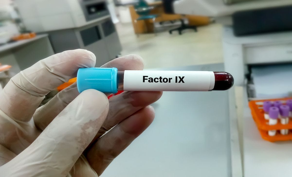 factor IX blooodwork | Image Credit: Saiful52-stock.adobe.com