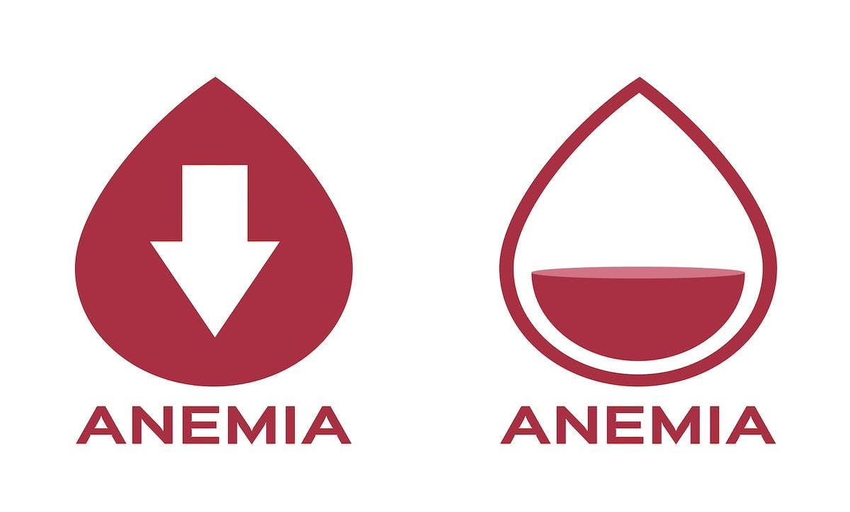 Anemia graphic | Image Credit: gritsalak-stock.adobe.com