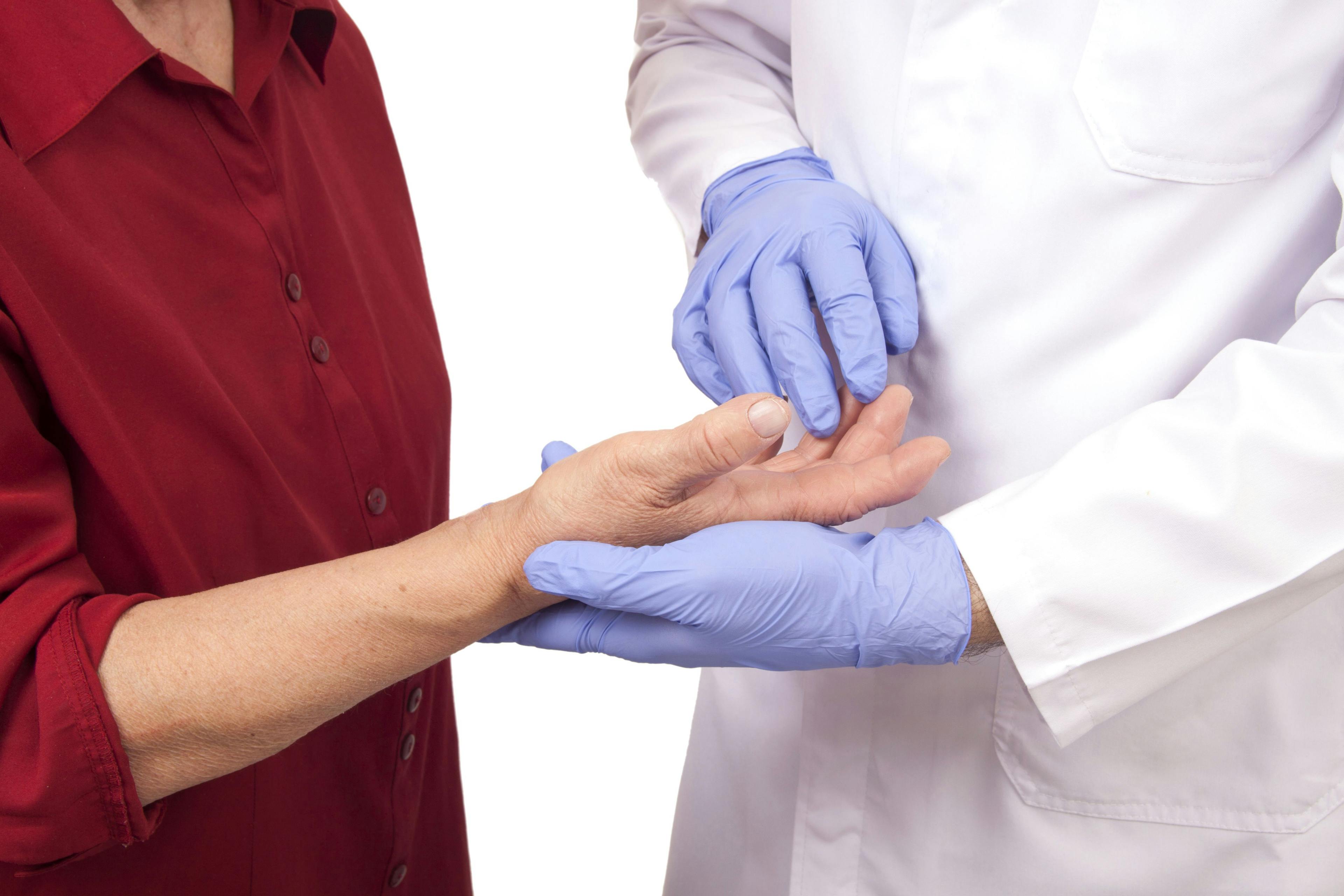 Physician checking patient's hand.