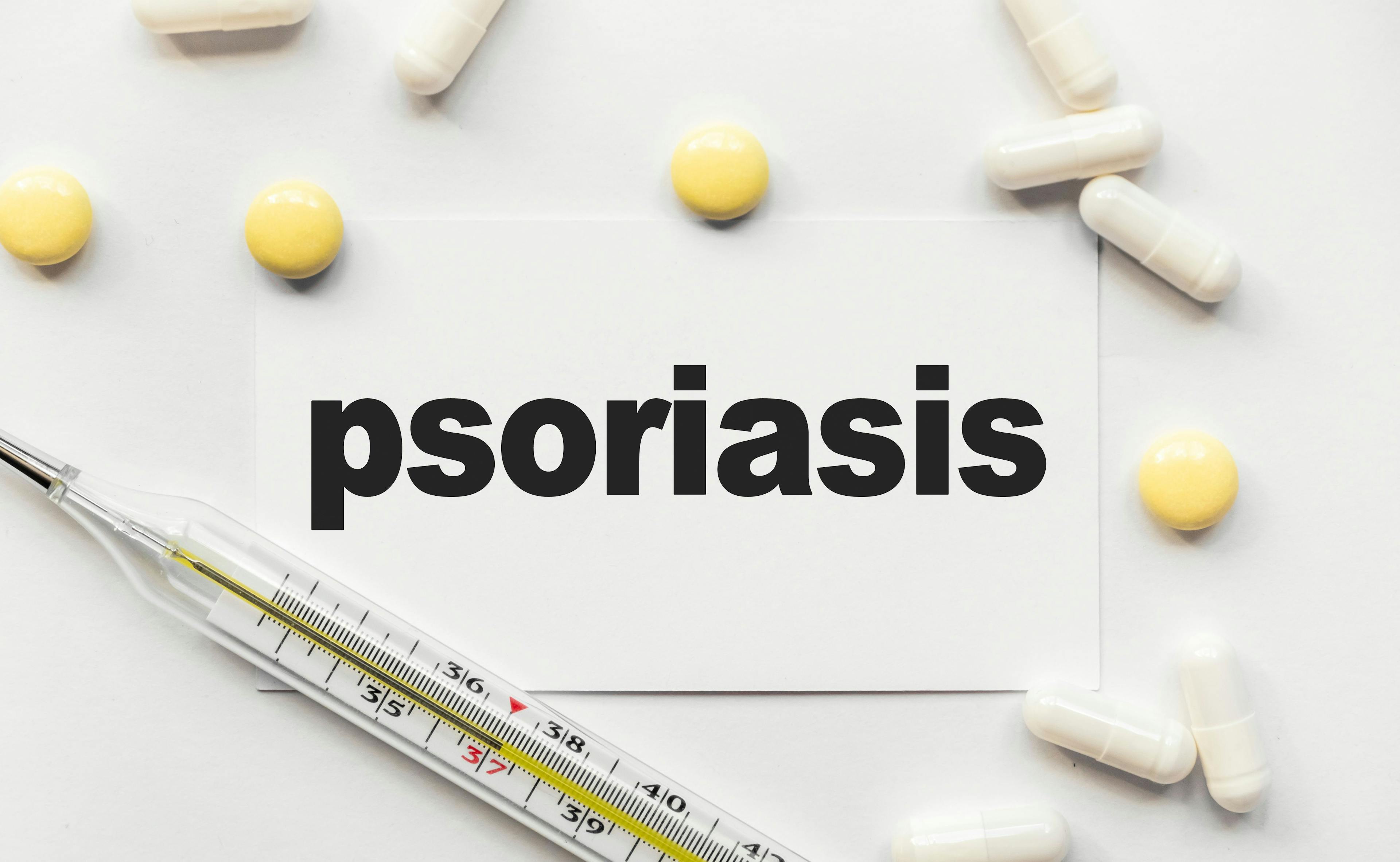 Psoriasis treatment concept | Image credit:vSviatlana - stock.adobe.com