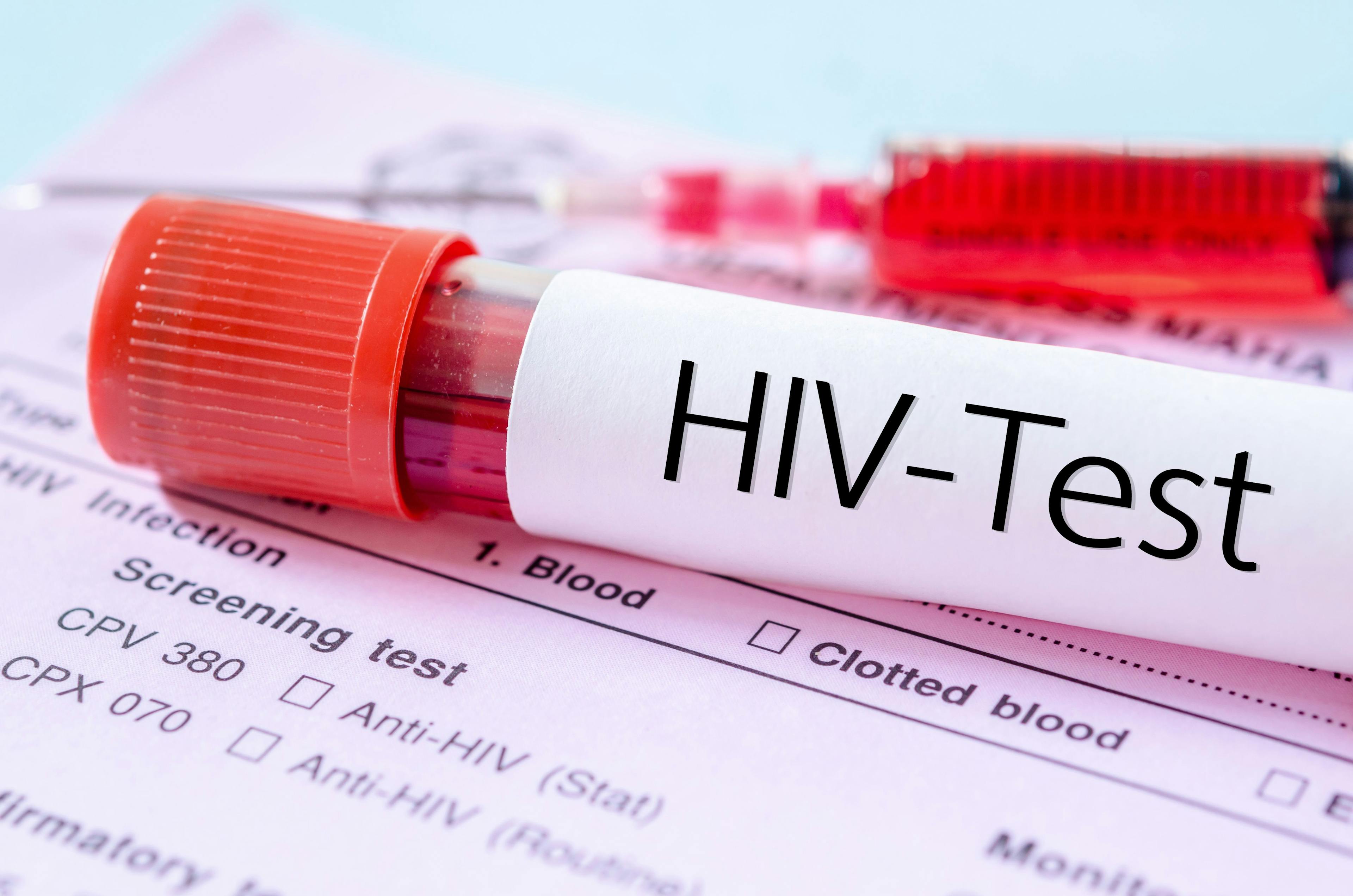 HIV test tube
