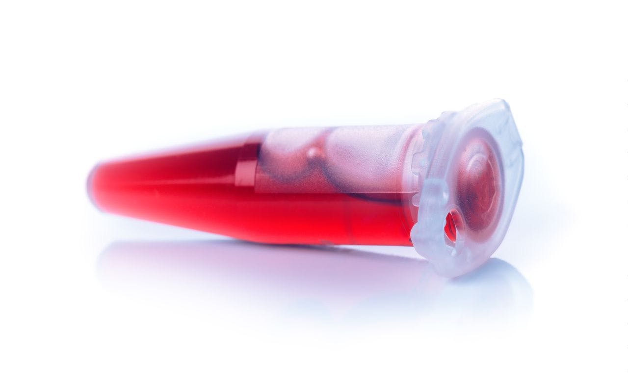 Image of a blood sample for liquid biopsy