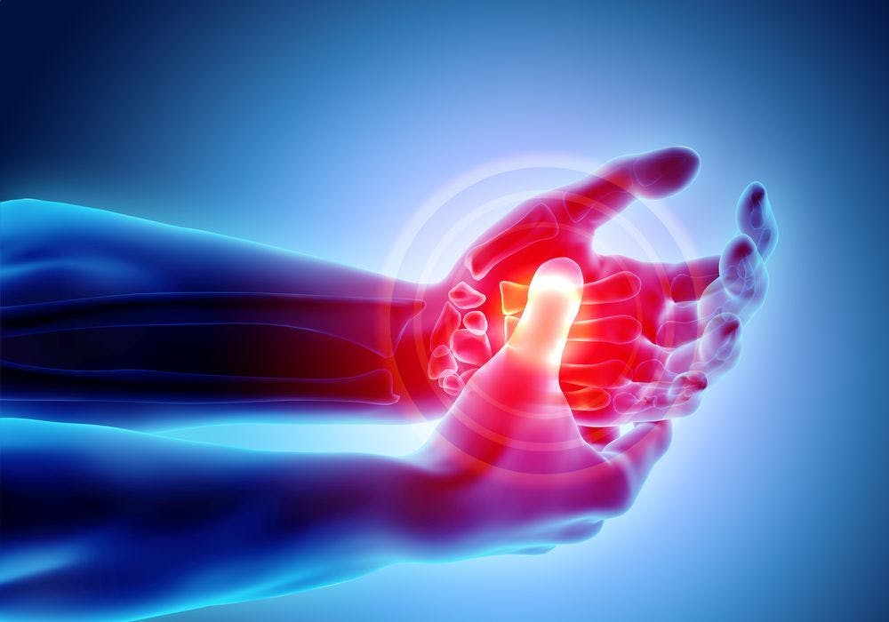 Hand with arthritis pain