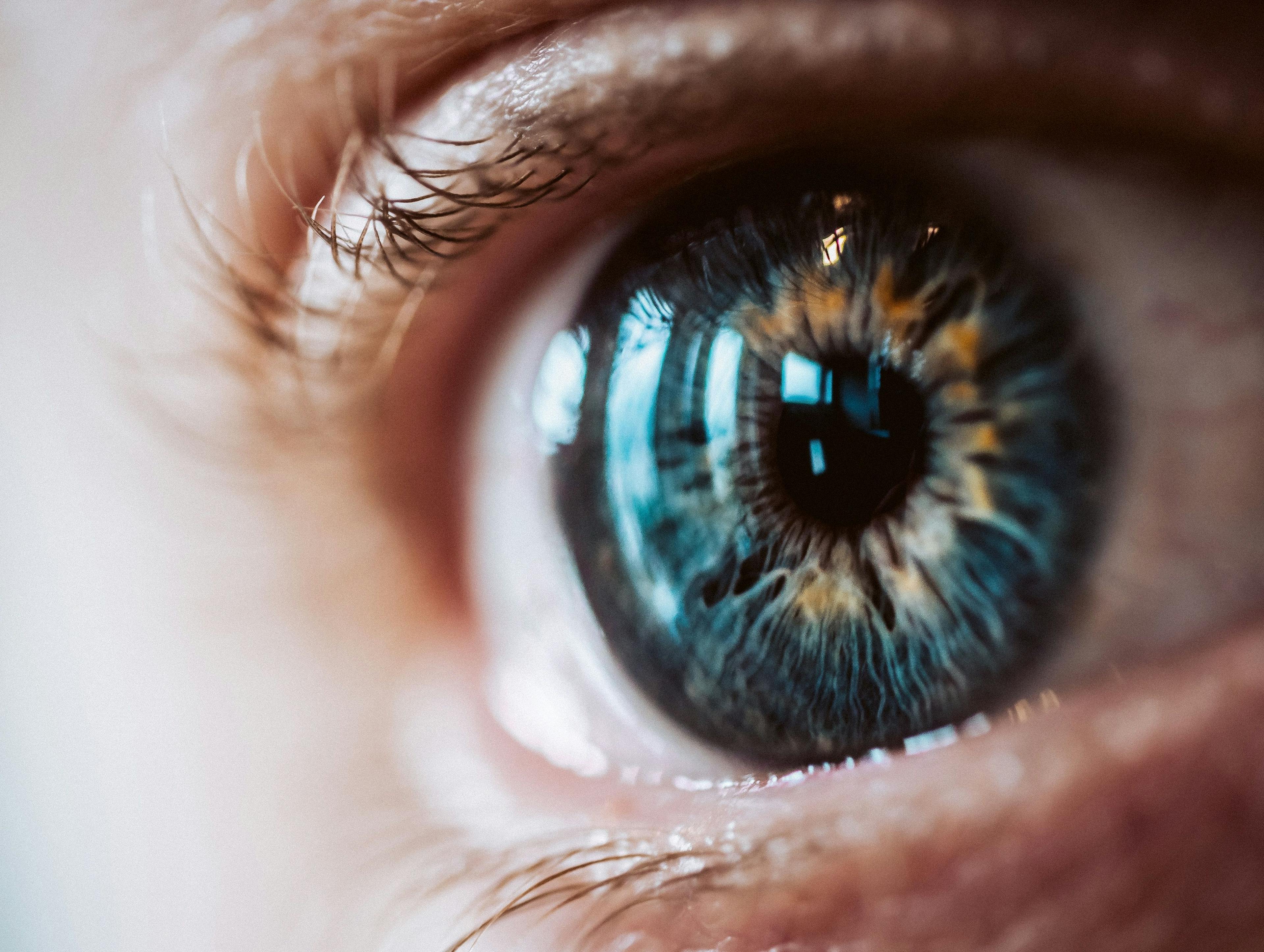 How an Eye Exam May Improve Early Diagnosis of Parkinson Disease
