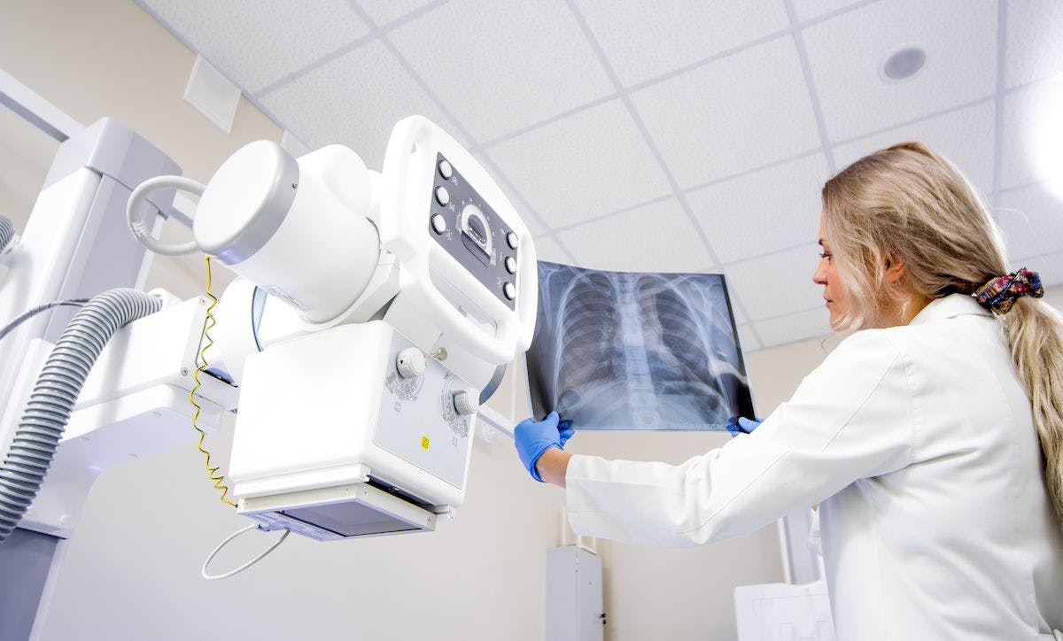 Oncologist examining lung cancer results | Image Credit: vladislav - stock.adobe.com