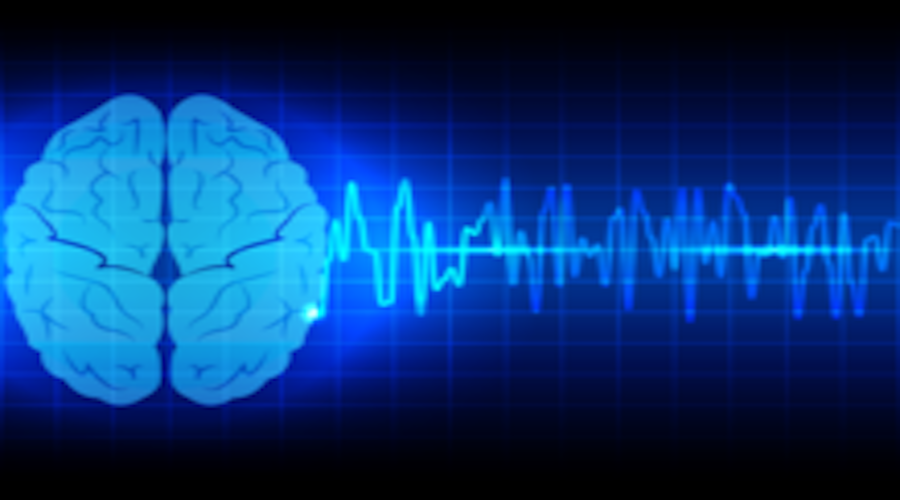 Image of brain waves