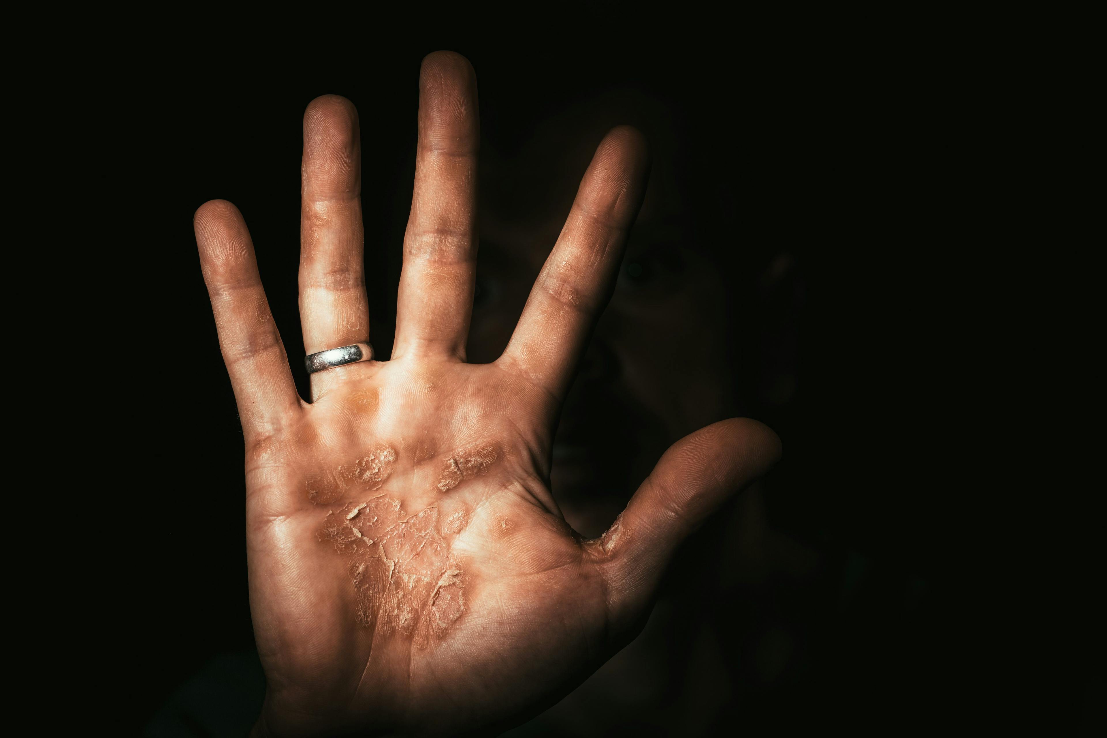 dark hand of a worker with b calluses protests. Stop | Image Credit:vovan - stock.adobe.com