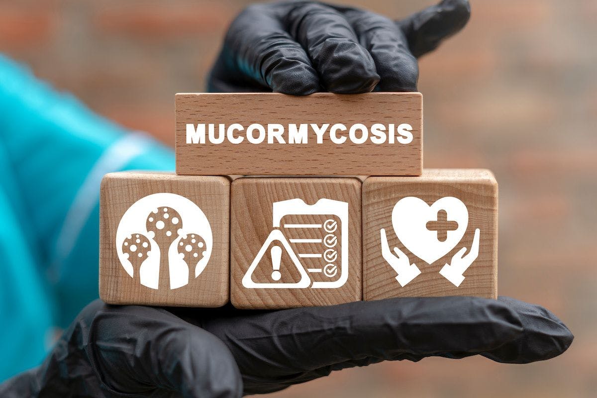 Mucormycosis mold fungus | Image Credit: © wladimir1804 - stock.adobe.com