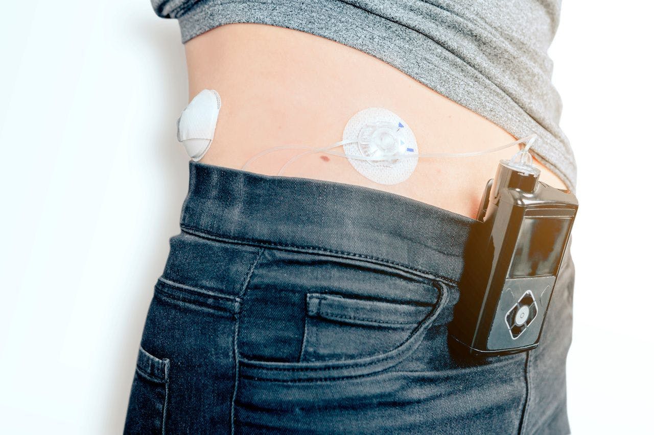 Children with diabetes admitted to non-intensive care units can continue using their home insulin pumps with the safety and efficacy as hospital-managed pumps.

Image credit: Carlo - stock.adobe.com