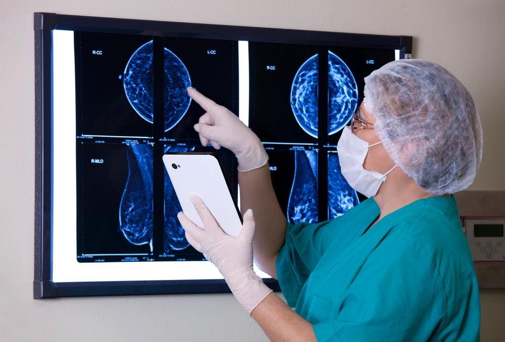 Image of breast cancer screening
