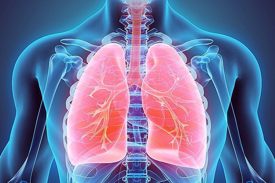 Long-term Mortality Decline in RA Skips Those Who Also Have Interstitial Lung Disease