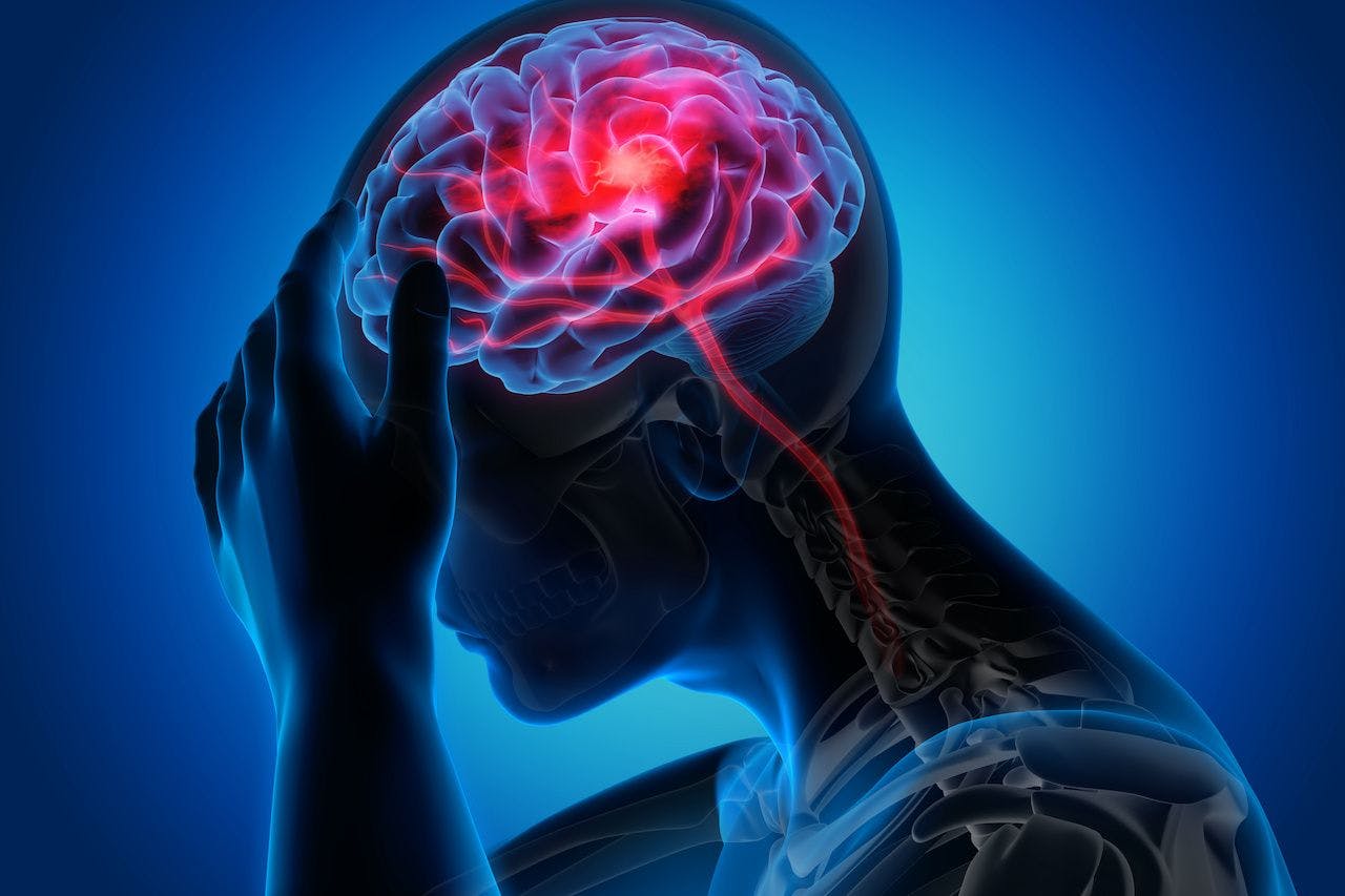 Stroke - blood supply to the brain: © peterschreiber.media - stock.adobe.com